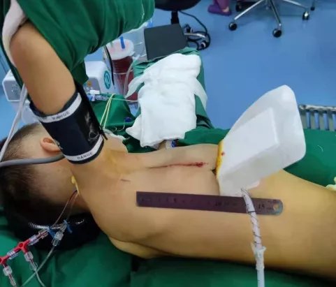 妙手|山东省立三院心脏大血管外科 为折翼的天使妙手“补心”