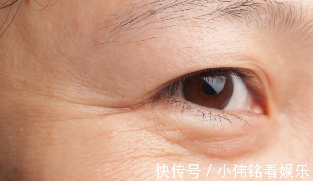 皮肤|吃水果能抗衰老?皮肤科医生:2种食物也可多吃,或可消除皱纹