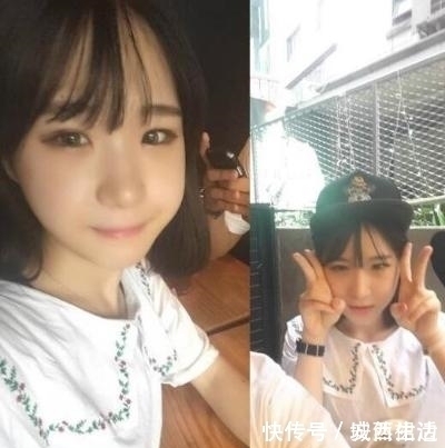 小脸|小脸确实更可爱,看完整容过程,只觉得满屏的疼痛