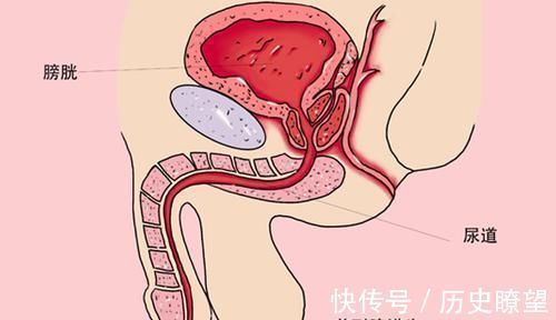 炎症|男性前列腺有问题,该做哪些男科检查保护前列腺,做什么好