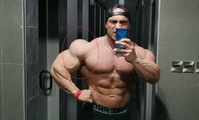 萨米尔|35岁的他身高只有165厘米,体重却高达98公斤,网友调侃肩膀好假