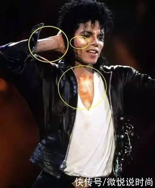 护肤品|熊果苷的护肤品真的可以美白吗