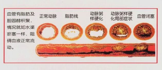 房子|心血管葛医生：打个比方讲讲不同类型的“心脏病”。