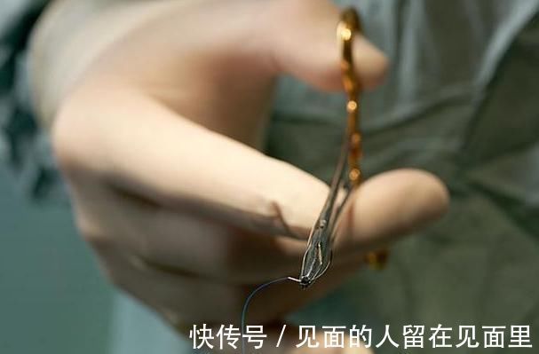 针头|生完孩子就不痛了这四种是真的疼啊,有的妈妈认为比生育更痛