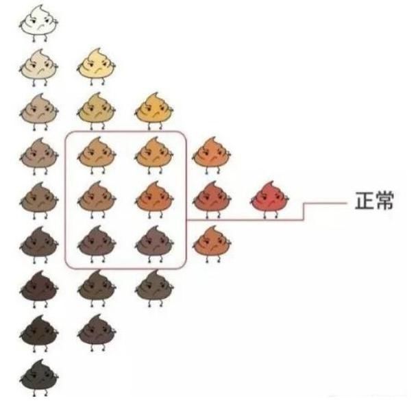 金黄色|便便是孩子健康的“晴雨表”,哪种健康哪种危险?宝妈要心里有数