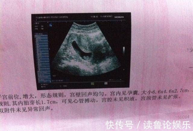 胎心率|怀孕后，如果怀孕的妈妈有这三场表演，也许她是肚子里的小公主，提前恭喜