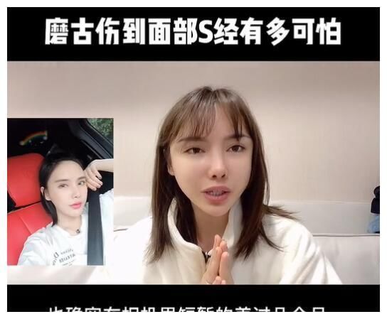 真实颜值|美女网红花70万却整形失败,磨骨伤到神经毁容,自叹非常后悔