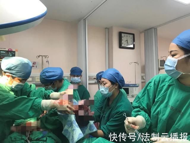 金医生|生死时速!金山一产妇脐带脱垂母婴危险,关键时刻