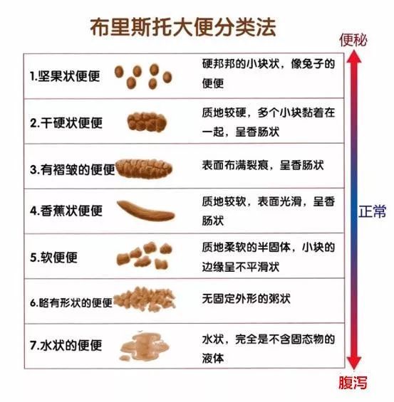 排尿|教你从大小便看健康 不同变化或暗示不同问题