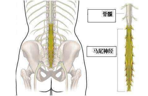  最为常见|你应该了解的腰间盘突出的知识，这样做，才能摆脱疼痛麻木