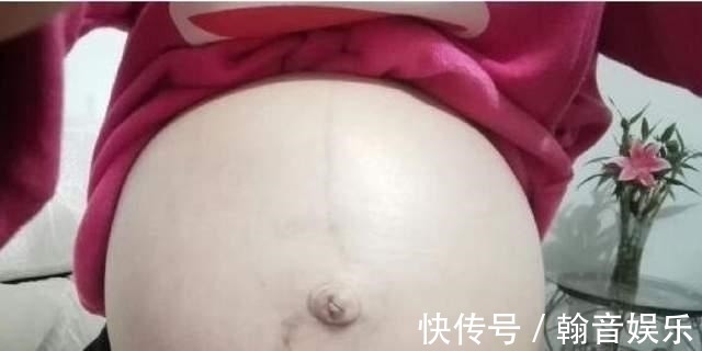 皮肤|怀孕后肚子上的“黑线”是什么？妊娠中线的秘密，你有必要了解