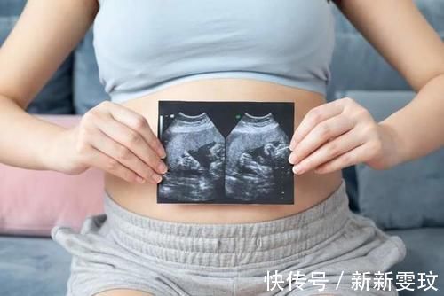 检查|接NT秒过！超级管用的注意事项！NT彩超一次性过！