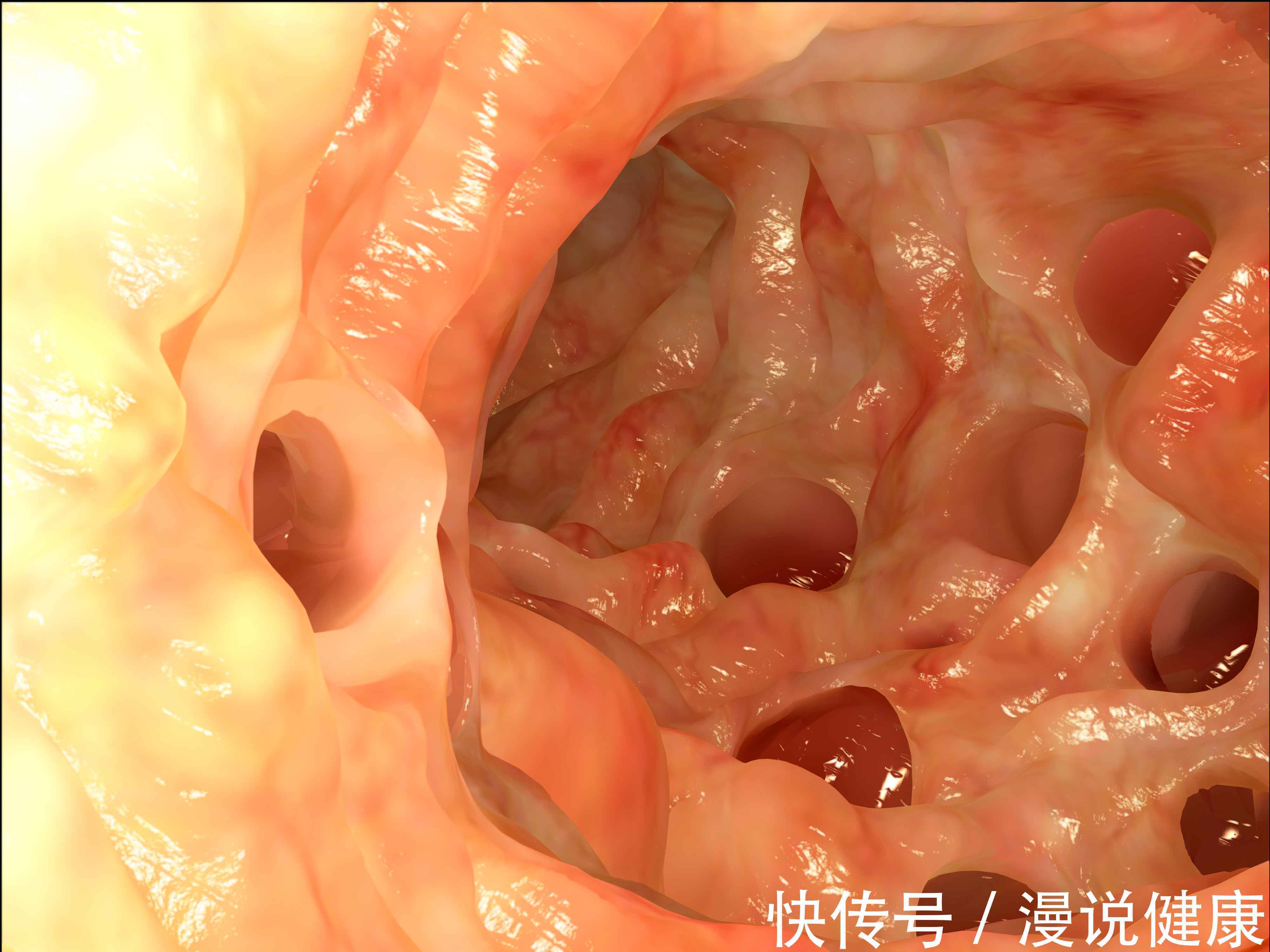 发病率|肠内有癌,大便告知?若排便出现这3种现象,警惕肠癌的到来!