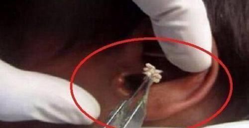 床头|男孩半夜“耳朵疼”,宝妈拿灯一照慌忙送医,这些东西别放床头了