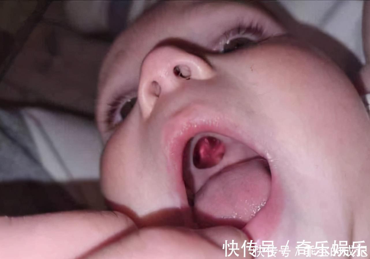 宝妈|宝宝嘴里有个洞?原来是“贴纸”惹的祸,五种物品婴幼儿要远离