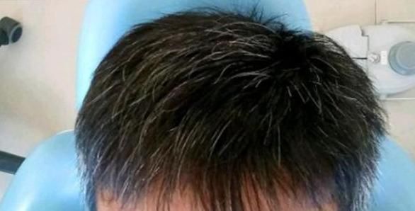 染发|民间一个土秘方,不管白发多严重,让你从此告别染发,了解一下