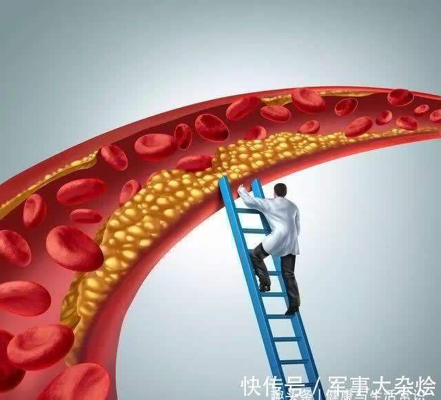 痛风|生花生和熟花生哪种更健康?提示:为了健康,5类人要谨慎吃花生