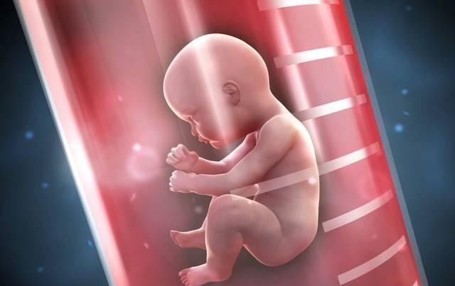 试管婴儿|国内首例试管婴儿已31岁,现状让不少人失望了,好处不得不提