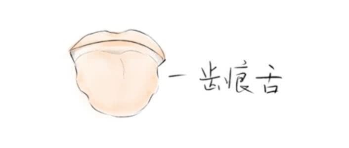 肢端|身上有三道“邪印儿”,说明健康要出问题