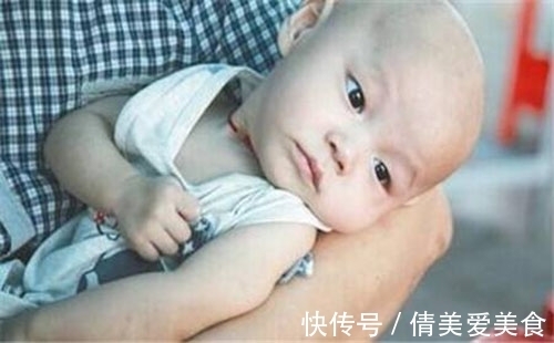 小儿脑瘫|脑瘫的晚期症状:小儿脑瘫患者,通常有什么表现?