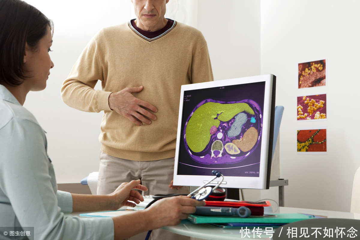 杀手|无形杀手“脂肪肝”
