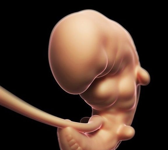 卵子|不想怀上“唐氏儿”，这3种情况孕妈最好避开，别傻傻不知道了！