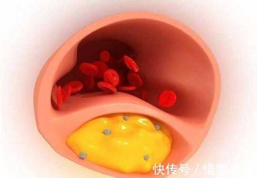 葛根条|血脂高的人,不想血管堵死,拿它煮水一喝,畅通血管,胜过降脂药