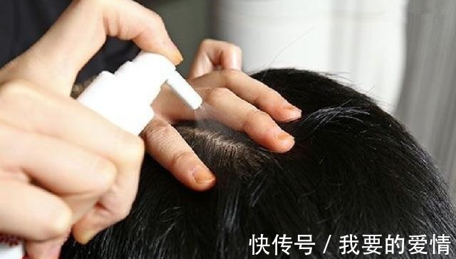 小妙招 白发多也不要频繁染发,伤发又上头皮,这四个小妙招解决白发困扰!