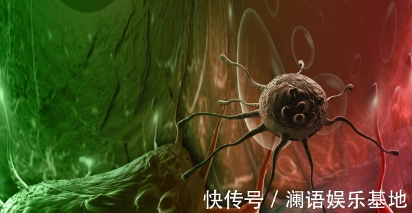 肿瘤医生|得了癌症怎么办?肿瘤医生说:这样做,可活的更久