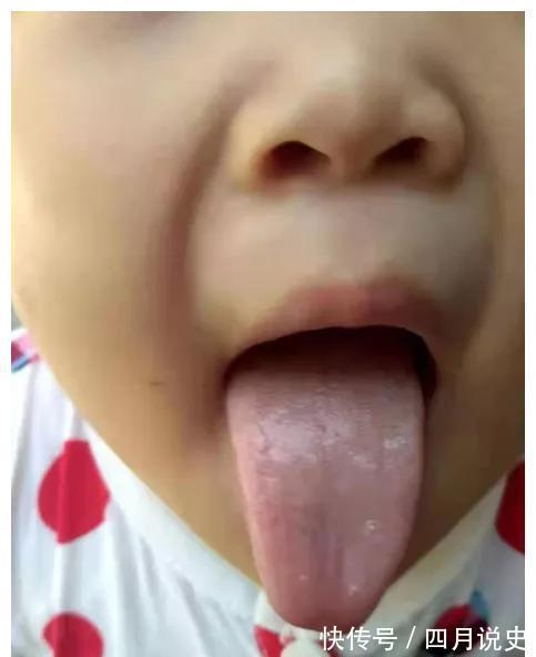 长高|孩子这样的舌苔,是很难长肉长高的
