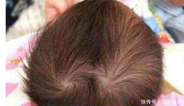 毛发|孩子头顶几个“旋”有什么说法可能不少人想“错”了,不妨一看!