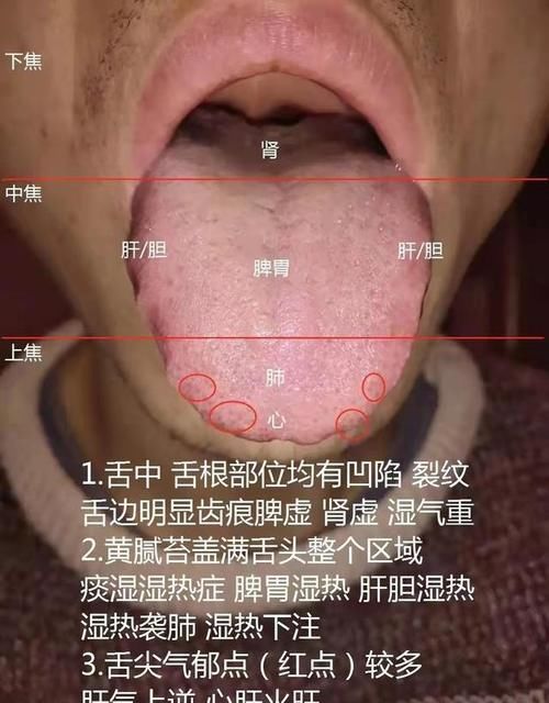 中医|嗓子里面会有痰，但咳不出来？中医：湿气重，调肝、调脾是关键