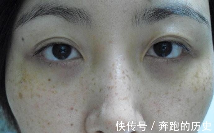 美白针|别用美白针美白肌肤,每天用不起眼小物抹脸,七天皮肤白出一个色