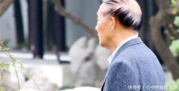 祛斑除皱|为啥有些七十岁老人不长老年斑做到这几点,或许你也可以没有斑