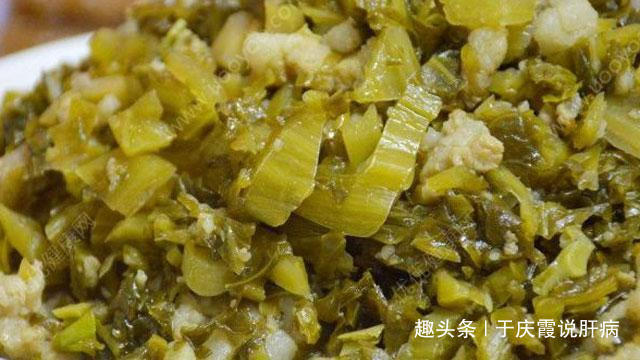 肝炎|乙肝人群,害怕肝炎转癌,“2种”食物,建议要少吃