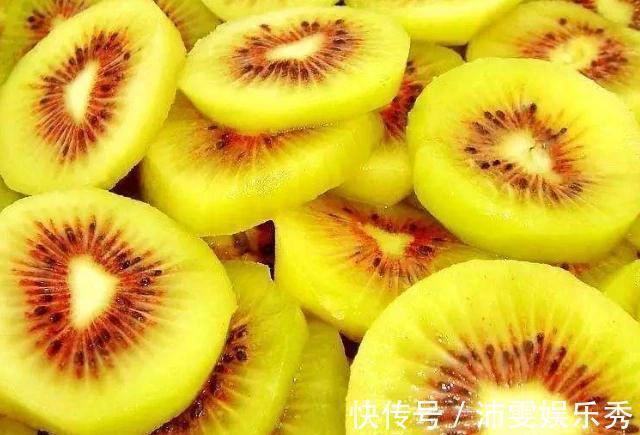 黄疸|孕妈在孕期,4物平时可劲儿吃,或许能清除胎毒,预防胎儿黄疸