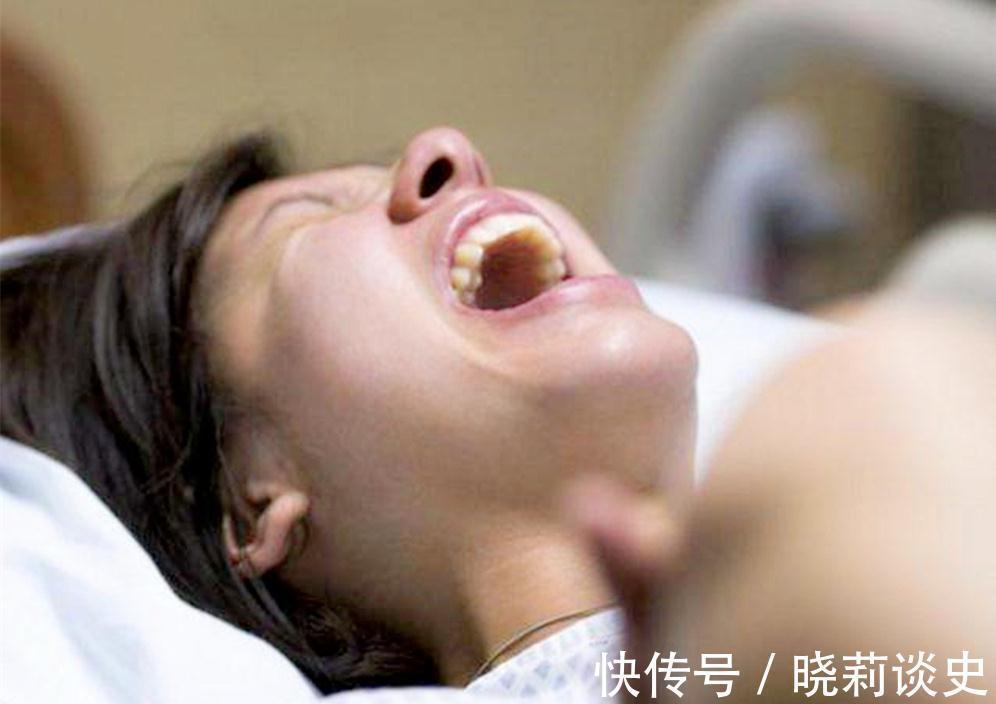 剖腹产|胎儿怎么从狭窄的产道出来的?除了产道弹性,胎儿的努力也很感人