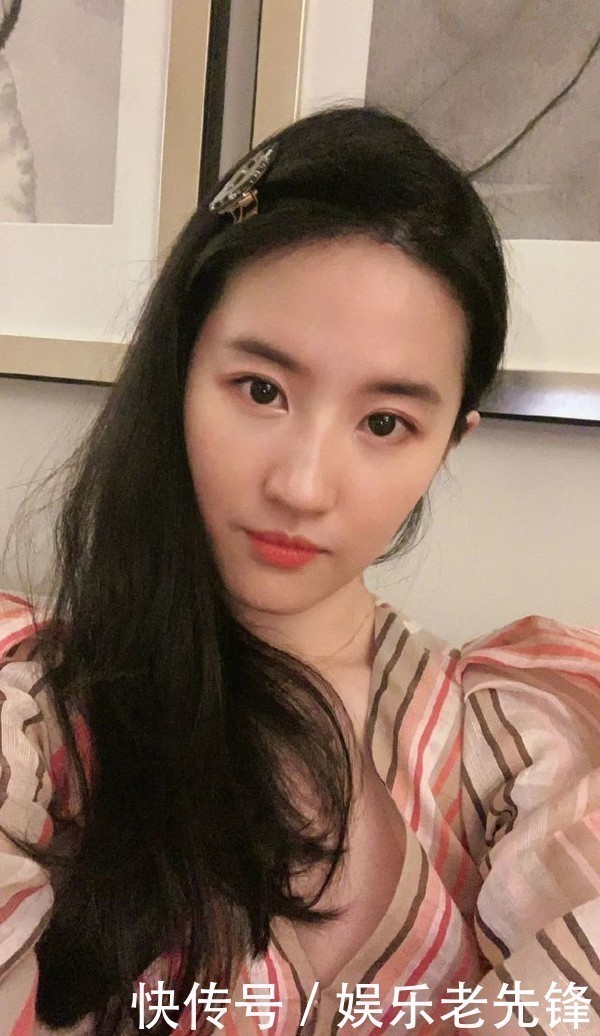 额头|为什么别人的美人线,是你害怕露出的发际线?