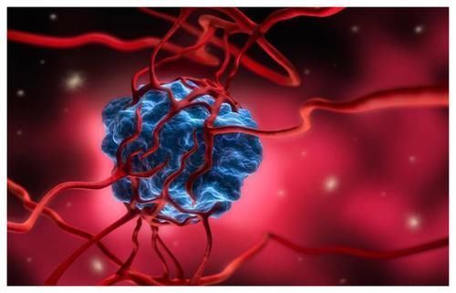 消化系统|不瞒你说：常吃这4样食物，可能是在“喂养”癌细胞