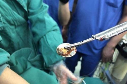 轩轩|30分钟男孩眼珠被“吃光”,罪魁祸首家家都有,家长一定要警惕