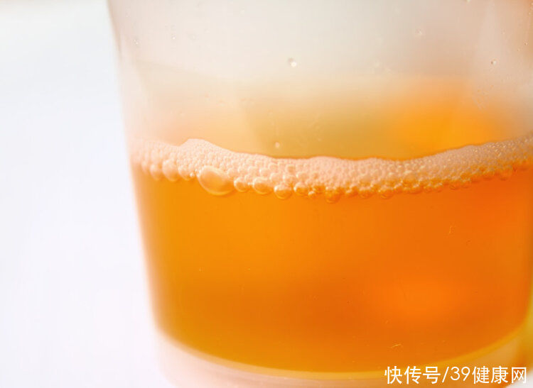 口渴|多喝水未必有益健康！重点强调：3类人喝太多水会伤身，别使劲喝