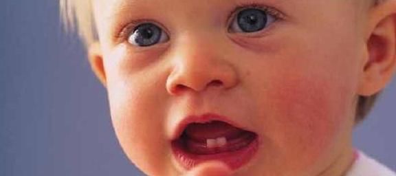 症状|宝宝身体出现这6种症状时,多半就是缺钙了,宝妈要多用点心