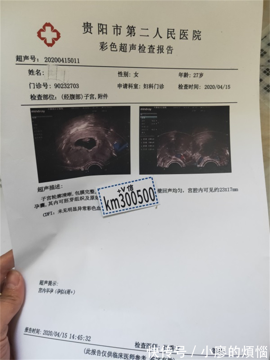 孕期做检查,B超检查or彩超b超报告单如何选