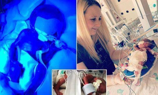 阿乐|英国妇女在怀孕21周时生下一个孩子宝宝是透明的,可以看到体内的血液流动