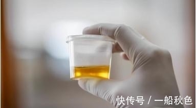 糖尿病|40%2型糖尿病人有肾病!记住7大危险因素,做好6件事预防!