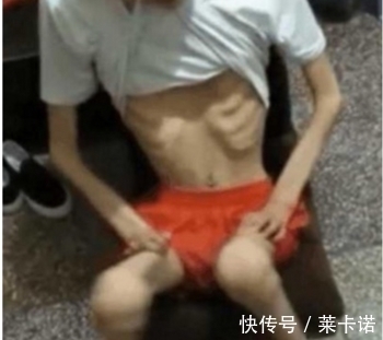 检查|17岁男孩瘦到40斤,去医院检查没病,他含泪道出事情真相