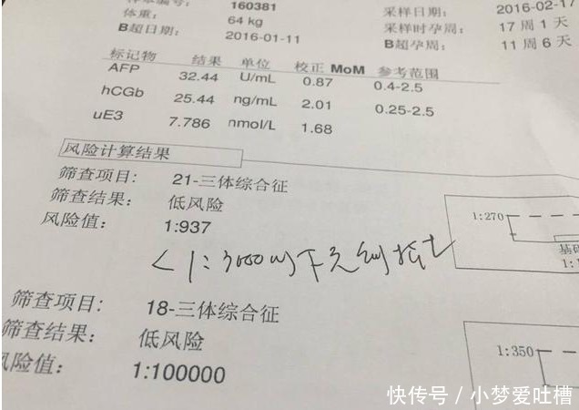 四维彩超|孕检过了这三关以后,孕妈就别担心,宝宝会健健康康