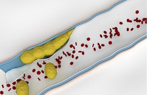 肝肾|一味中药坚持服用20天,就能把血脂降到正常
