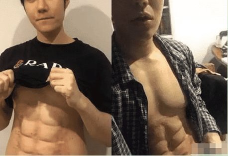 手术|24岁小哥花26000通过手术雕出6块腹肌，恢复后像填充棉絮的布偶