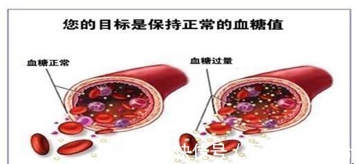 紫菜多糖|内分科主任 糖尿病很怕这6种蔬菜, 糖友多吃点